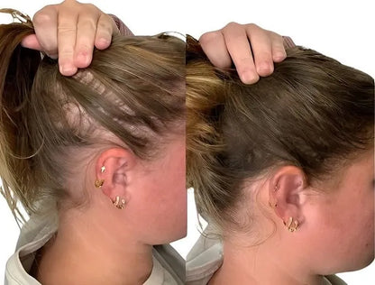 Daureve EscovaCapilar™